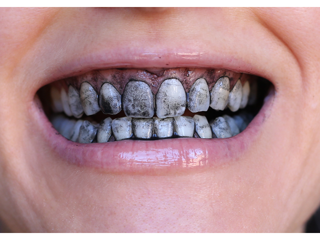 Black & White Tooth Polish